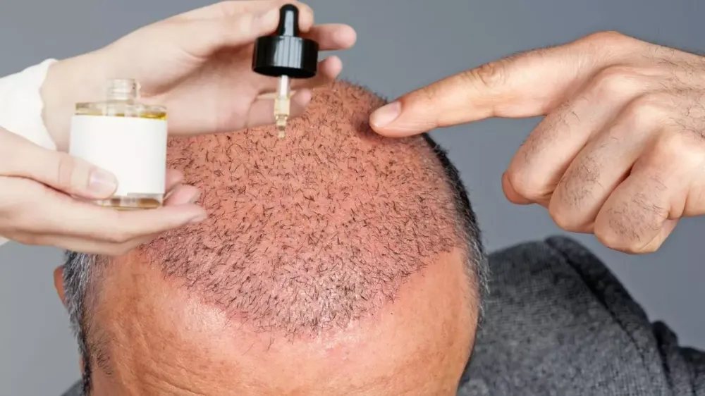 Saç Besleyen Yağlar: Saç Sağlığını Destekleyen Doğal yağlar - Velvashair