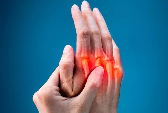 Artrit Nedir | Romatoid Artrit Belirtileri